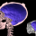 Real or Hoax: What CT Scans Actually Show