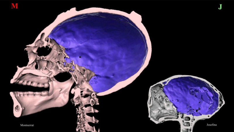 Real or Hoax: What CT Scans Actually Show